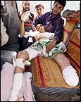 16 yr Assaduleh, one of the first civilians hit by US missile