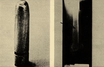 IMG#s 4-5: miracle bullet &amp; its X-ray fragment