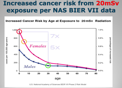 Increased Cancer Risk by Age at Exposure to 20 mSv Radiation